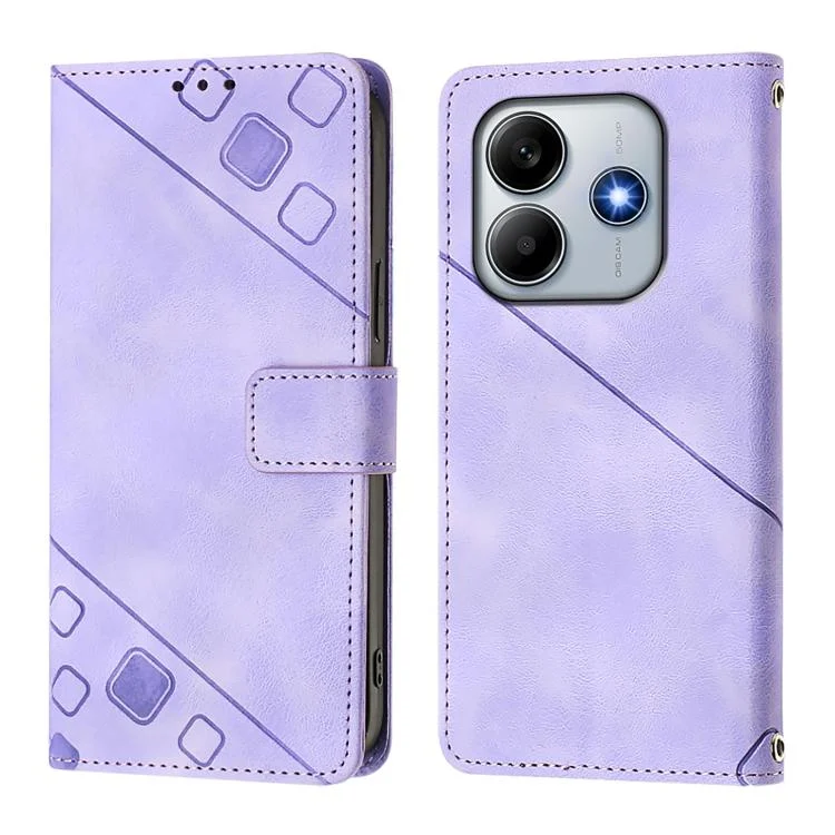 EDA006939504A_1.webp Skin-feel Embossed Leather Phone Case, For Redmi Note 14 4G 163.25mm, For Redmi Note 14 5G Global, For Redmi Note 14 Pro 5G Global - Image 2