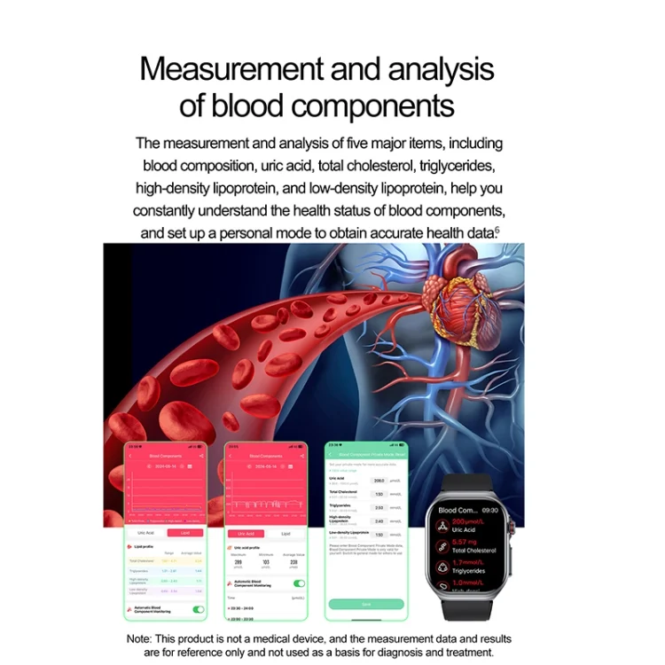 EDA0070388_B5.webp ET585 2.04 inch Nylon Strap IP68 Waterproof Smart Watch, Support ECG / Blood Composition Measurement - Image 6