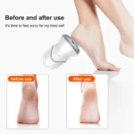 Electric Vacuum Design Foot Grinder Household Multifunctional Pedicure Calluses Foot Care - Image 5