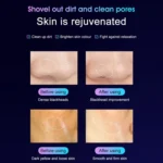 YJK028 3.7V 250mAh Second Generation Ultrasonic Ion Cleansing Instrument - Image 5