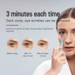 YJK029 3.7V 280mAh Ion Color Light Eye Beauty Instrument - Image 7