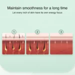 FY-B503 Portable Laser Hair Removal Device Photon Electric IPL Intense Pulse Hair Remover - Image 2