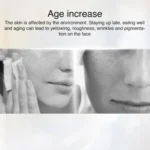 AF-101 Home Milk Light DPL Freezing Point Photon Skin Rejuvenation Device - Image 6