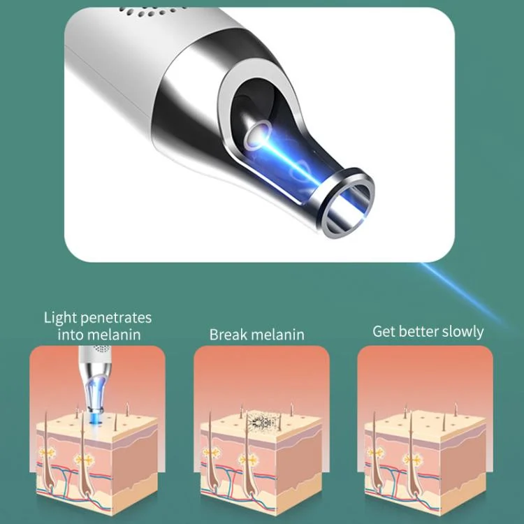 EDA0080443_B4.webp AA-A401 Portable Laser Beauty Instrument Mole Removal Freckle Removal Beauty Laser Pen - Image 5