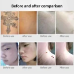 AA-A401 Portable Laser Beauty Instrument Mole Removal Freckle Removal Beauty Laser Pen - Image 8