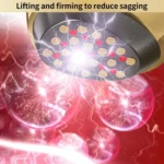 WG-SP-MS1135 EMS Collagen Cannon Essence Introducer Photon Skin Rejuvenation RF Beauty Device - Image 9