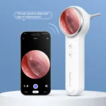 TESLONG SA200 1.85 Inch Screen WIFI Handheld Smart Visual Otoscope - Image 4
