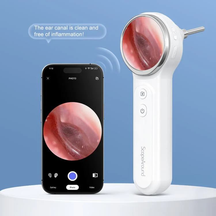EDA008392401A_3.webp TESLONG SA200 1.85 Inch Screen WIFI Handheld Smart Visual Otoscope - Image 4