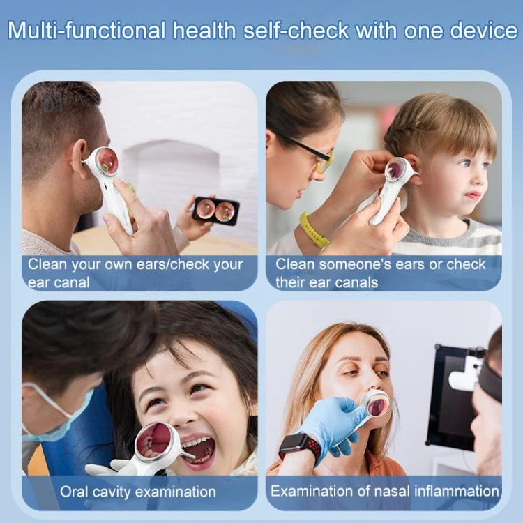 EDA008392401A_5.webp TESLONG SA200 1.85 Inch Screen WIFI Handheld Smart Visual Otoscope - Image 6