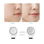 YJK059 Multifunctional Color Light Lead-in Instrument Negative Ion Beauty Instrument - Image 4