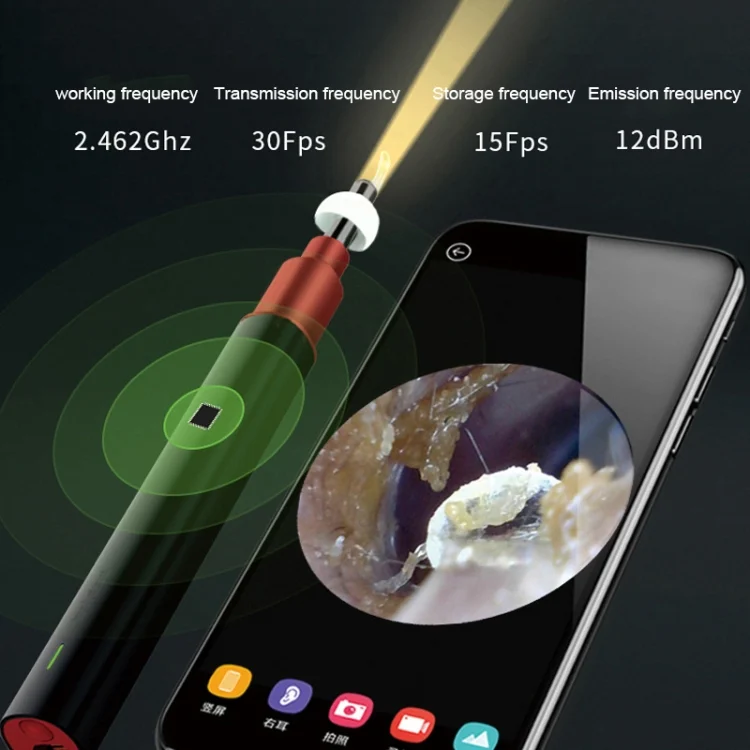 HC0344B_7.webp Bebird B1 Intelligent HD Visual Ear Cleaner Earwax Tool, Standard Version - Image 9