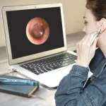 i95 3 in 1 USB Ear Scope Inspection HD 0.3MP Camera Visual Ear Spoon for OTG Android Phones & PC & MacBook, 1.75m Length Cable - Image 12