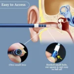 i95 3 in 1 USB Ear Scope Inspection HD 0.3MP Camera Visual Ear Spoon for OTG Android Phones & PC & MacBook, 1.75m Length Cable - Image 8