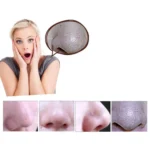 5W 1A Multi-function Blackhead Extractor Pore Cleanser with Four Probes - Image 9