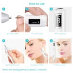 Xpreen XPRE061 Professional Dark Spot Remover Freckle Tattoo Chargeable Wart Mole Remover, with LED Screen and Spotlight - Image 8