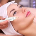 Xpreen XPRE061 Professional Dark Spot Remover Freckle Tattoo Chargeable Wart Mole Remover, with LED Screen and Spotlight - Image 10