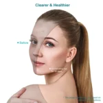 Xpreen  Blue & Red Light Therapy Acne Treatment Face Mask - Image 6