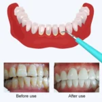 LSHOW YJK015A 3.7V USB Charging Five-speed Mode Waterproof Household Electric High-frequency Vibration Teeth Polisher - Image 6