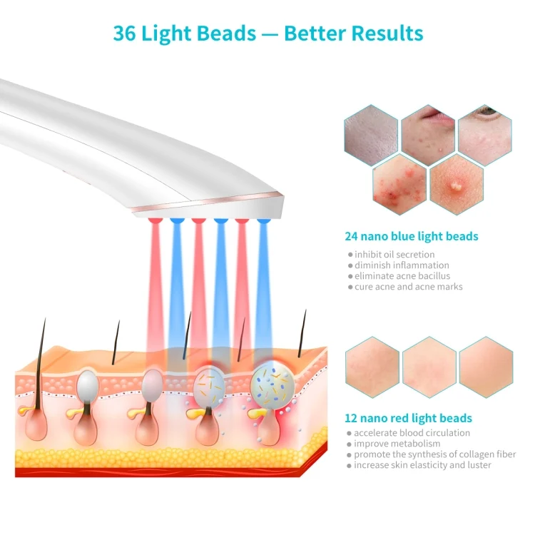 HCB8042W_2.webp XPREEN XPRE052 Wireless Rechargeable Light Acne Treatment Device Home Acne Clearing Eraser with Blue Light and Red Light - Image 3
