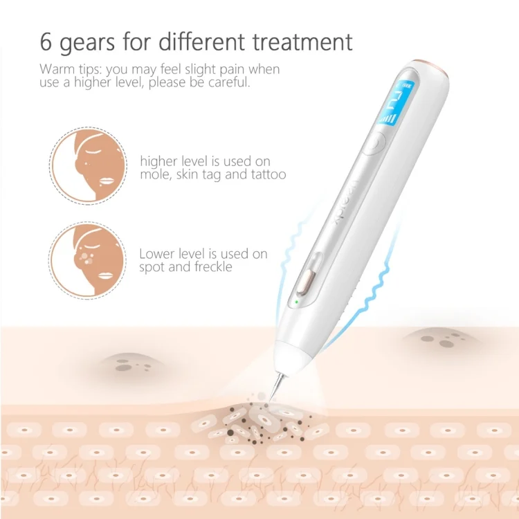 HCB8047W_5.webp XPREEN XPRE051 Professional Wireless Rechargeable Mole Freckle Dark Spots Tattoo Wart Removal Pen Skin Tag Spot Eraser Pro Beauty Sweep Spot Pen Kit With LED Screen & Spotlight - Image 6