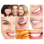 3pcs Replacement Brush Heads for Sonic Electric Toothbrush - Image 5