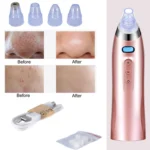 Face Pore Cleaner Blackhead Remover Vacuum Comedo Suction Diamond Dermabrasion Facial Cleaning Beauty Machine - Image 3