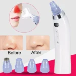 Face Pore Cleaner Blackhead Remover Vacuum Comedo Suction Diamond Dermabrasion Facial Cleaning Beauty Machine - Image 4