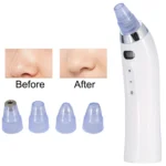 Face Pore Cleaner Blackhead Remover Vacuum Comedo Suction Diamond Dermabrasion Facial Cleaning Beauty Machine - Image 7
