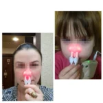 BIONASE Nose Care Therapy Machine Rhinitis Sinusitis Cure Hay Fever Treatment Machine - Image 2