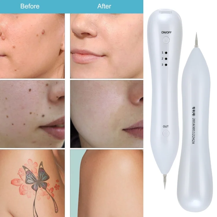 TBD04170071_12.webp Dark Spot Remover USB Laser Plasma Pen Facial Freckle Wart Removal Beauty Care Device - Image 13