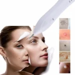 Dark Spot Remover USB Laser Plasma Pen Facial Freckle Wart Removal Beauty Care Device - Image 10