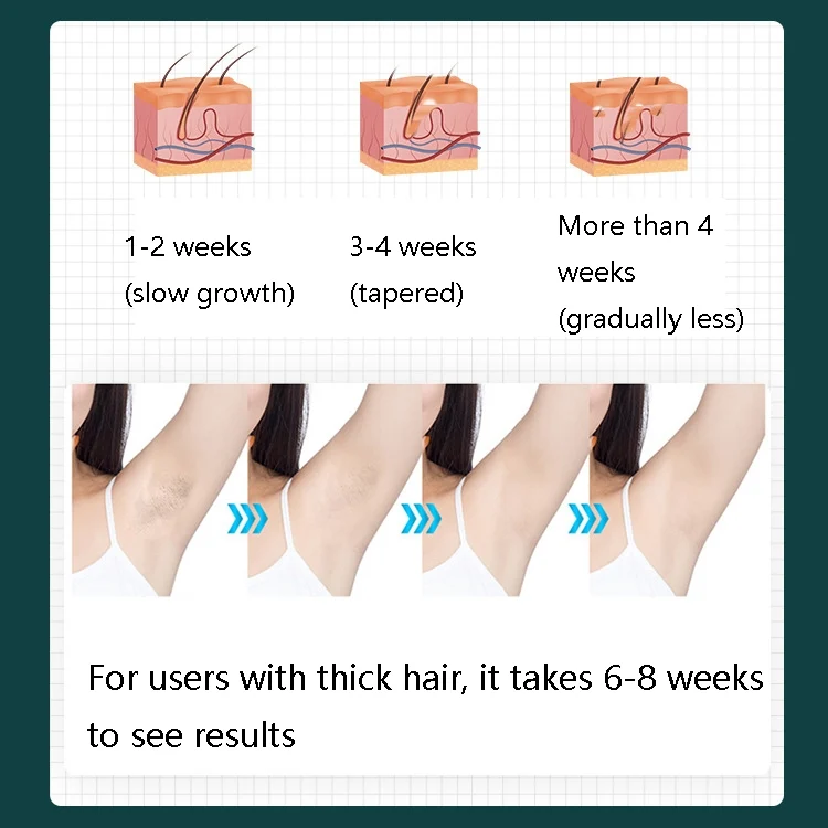 TBD0420733201_B5.webp FY-B500 Laser Hair Removal Equipment Household Electric IPL Hair Removal Machine - Image 6