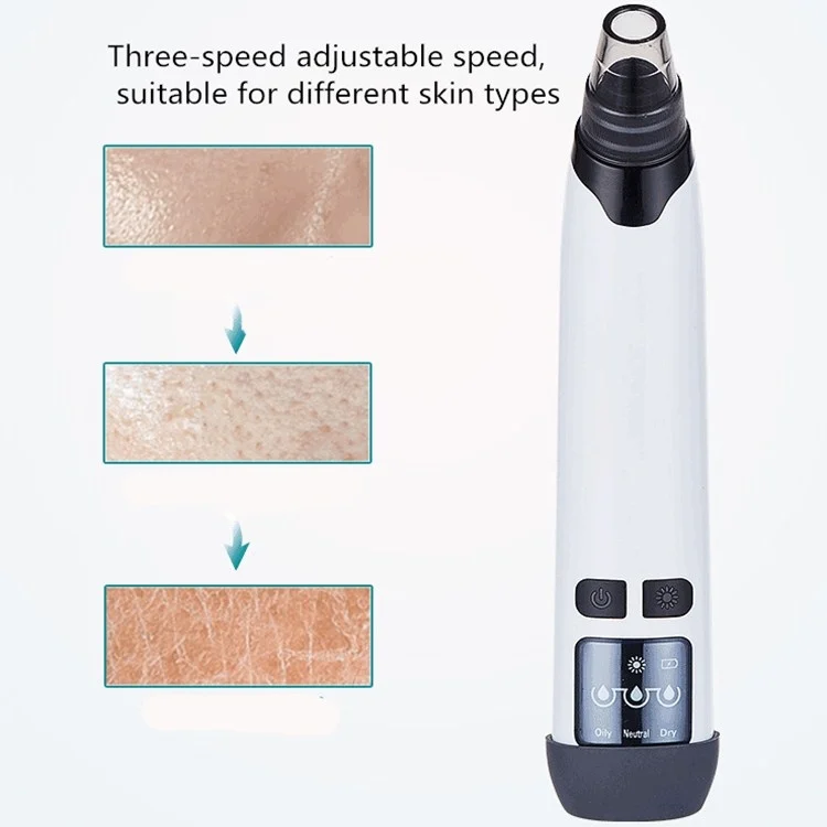 TBD04267403_3.webp 3-in-1 Temperature Sensor Blackhead Heating Electric Pore Cleaner Facial Acne Removing Device - Image 4