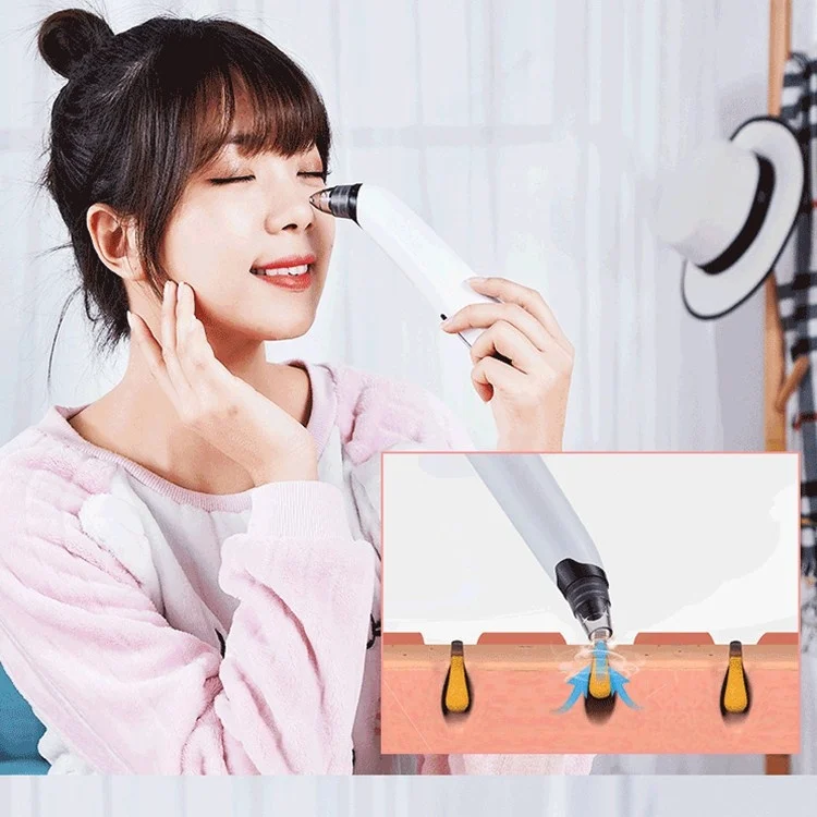 TBD04267403_5.webp 3-in-1 Temperature Sensor Blackhead Heating Electric Pore Cleaner Facial Acne Removing Device - Image 6