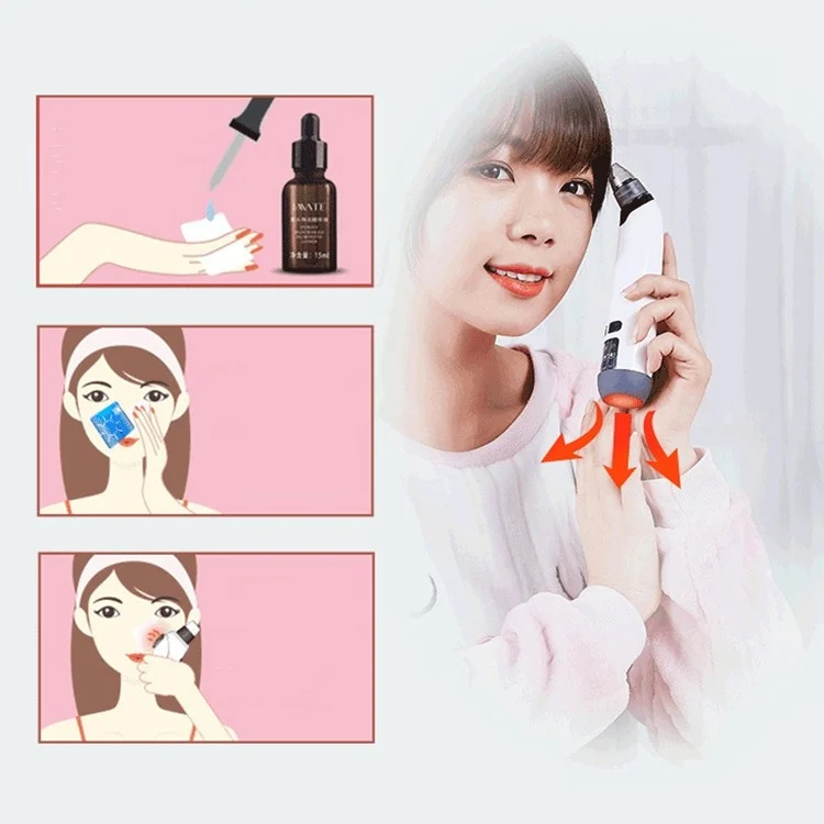 TBD04267403_6.webp 3-in-1 Temperature Sensor Blackhead Heating Electric Pore Cleaner Facial Acne Removing Device - Image 7
