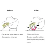 Cervical Spine Pillow Stretching Massager Orthosis Portable Neck Pillow - Image 4