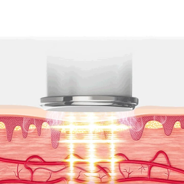 TBD050049801A_4.webp Pulse Multifunctional Hot Compress Physiotherapy Shoulder and Neck Cervical Massager Neck Protector - Image 5