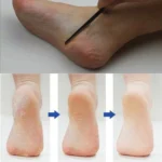 Pedicure Manicure Nail Cleaner Cuticle Grooming Dead Skin Planer Beauty Foot Care Tool - Image 2