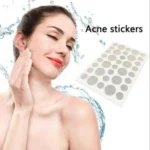 3 PCS Acne Tool Set Treatment Acne Scar  Pimples Sticker - Image 5