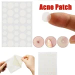 3 PCS Acne Tool Set Treatment Acne Scar  Pimples Sticker - Image 6