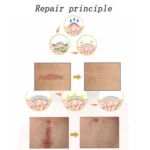Organic silicone Gel Scar Therapy Patch  be Washed and Reused - Image 4