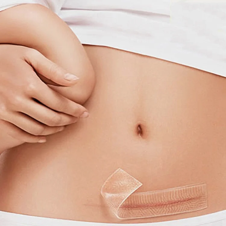 TBD0538637_5.webp Organic silicone Gel Scar Therapy Patch  be Washed and Reused - Image 6
