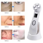 Radio Mesotherapy Electroporation Face Beauty Pen Radio Frequency LED Photon Face Skin Rejuvenation Remover Wrinkle - Image 11