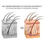 Radio Mesotherapy Electroporation Face Beauty Pen Radio Frequency LED Photon Face Skin Rejuvenation Remover Wrinkle - Image 9