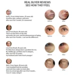 Radio Mesotherapy Electroporation Face Beauty Pen Radio Frequency LED Photon Face Skin Rejuvenation Remover Wrinkle - Image 10