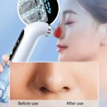 Small Bubble Home Beauty Equipment Multifunctional Electric Blackhead Suction Instrument Facial Pore Cleaner - Image 5