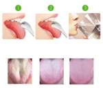 Tongue Cleaner Bad Breath Stainless Steel Cleaning Brush Tongue Scraper + Two-piece Set (Rose Gold ) - Image 5