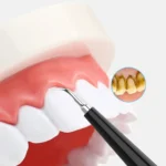 JYQ-023 Oral Tooth Cleaning and Care Tool Household Electric Dental Instrument for Removing Yellow Teeth and Tobacco Stains - Image 6