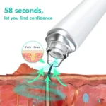Home Beauty Instrument WIFI Visual Electric Blackhead Cleaning Instrument - Image 5