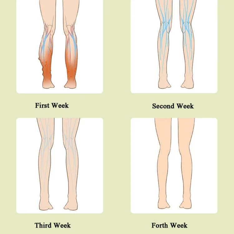 TBD0571989101_B4.webp Leg Massager Calf Air Wave Massager Household Varicose Vein Physiotherapy Device - Image 5